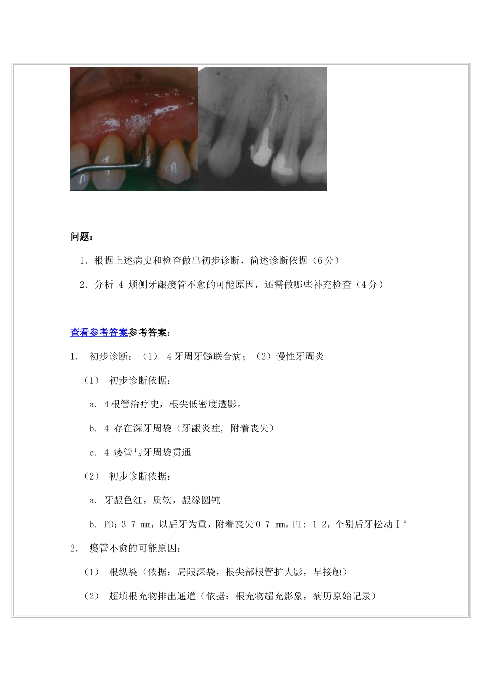 口腔医学院牙周病学-病例分析_第2页