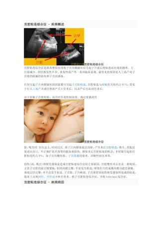 宫腔粘连综合征