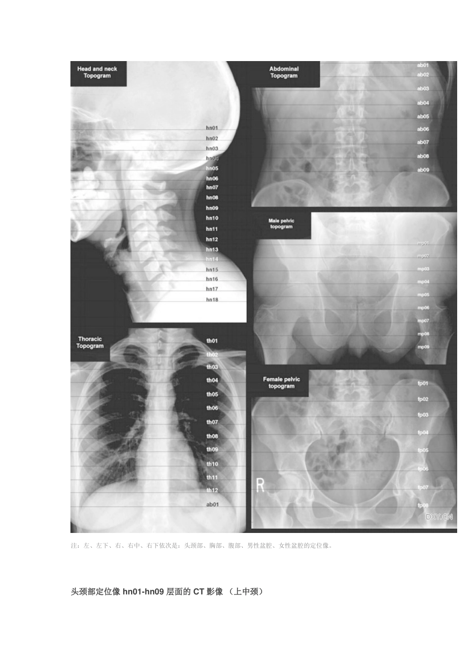 经典：全身淋巴结分区 CT 图谱_第2页