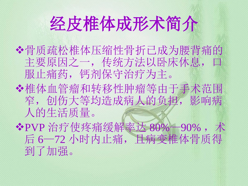 经皮椎体成形术(PVP)_第2页