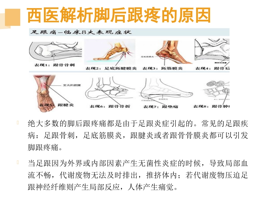 脚后跟疼一般是什么原因引起的_第3页