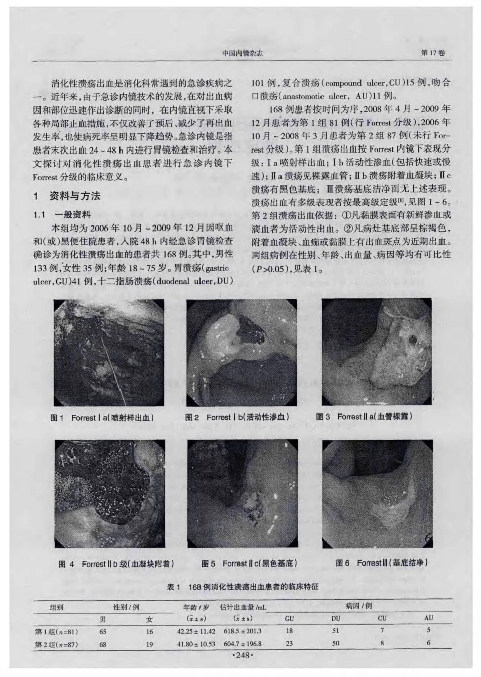 急诊内镜对消化性溃疡出血进行Forrest分级的临床应用(1)_第2页