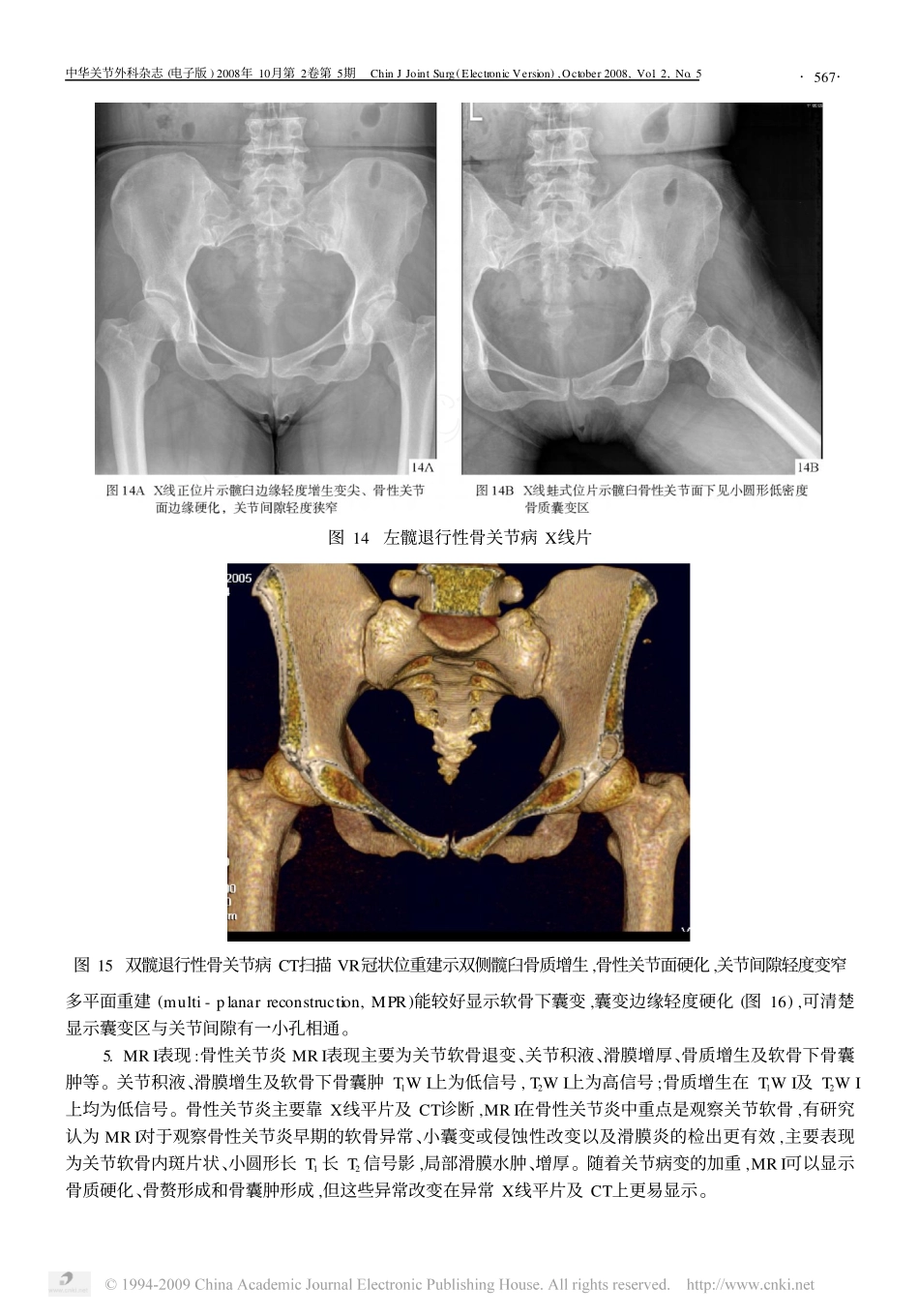 髋关节常见疾病的影像学诊断_二__第2页