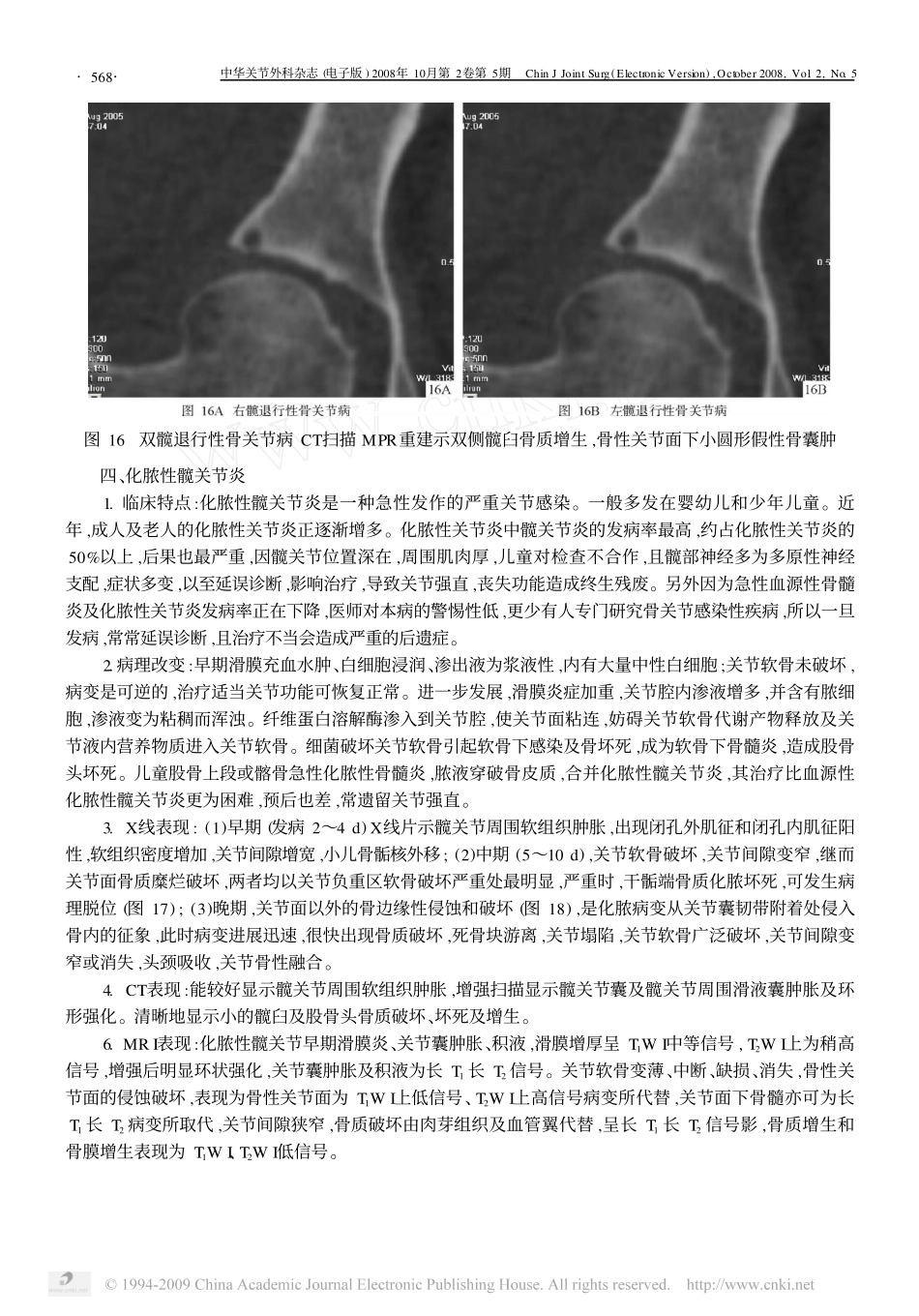 髋关节常见疾病的影像学诊断_二__第3页
