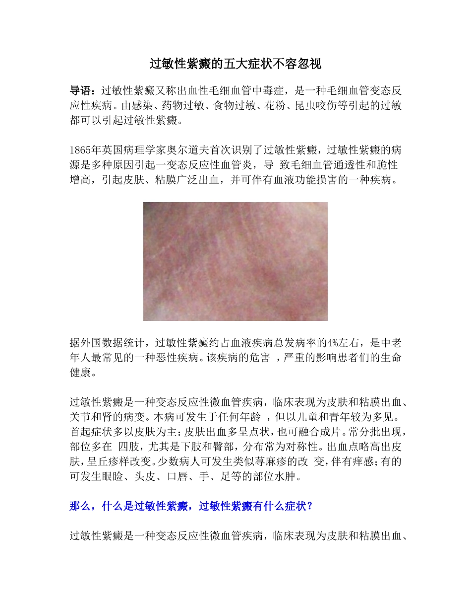过敏性紫癜的五大症状不容忽视_第1页
