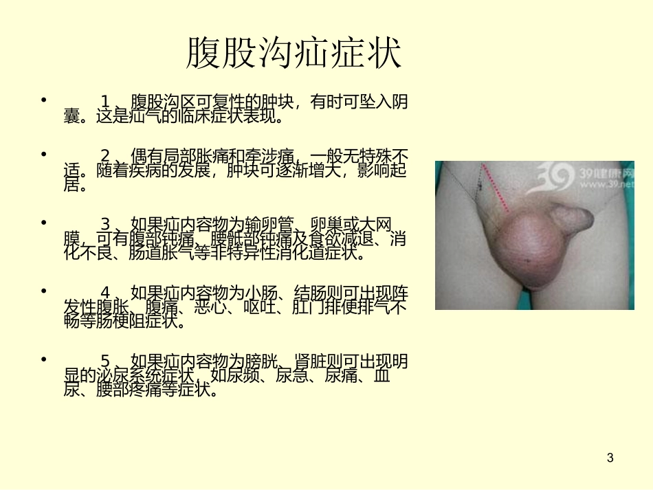 腹股沟疝的治疗方法_第3页