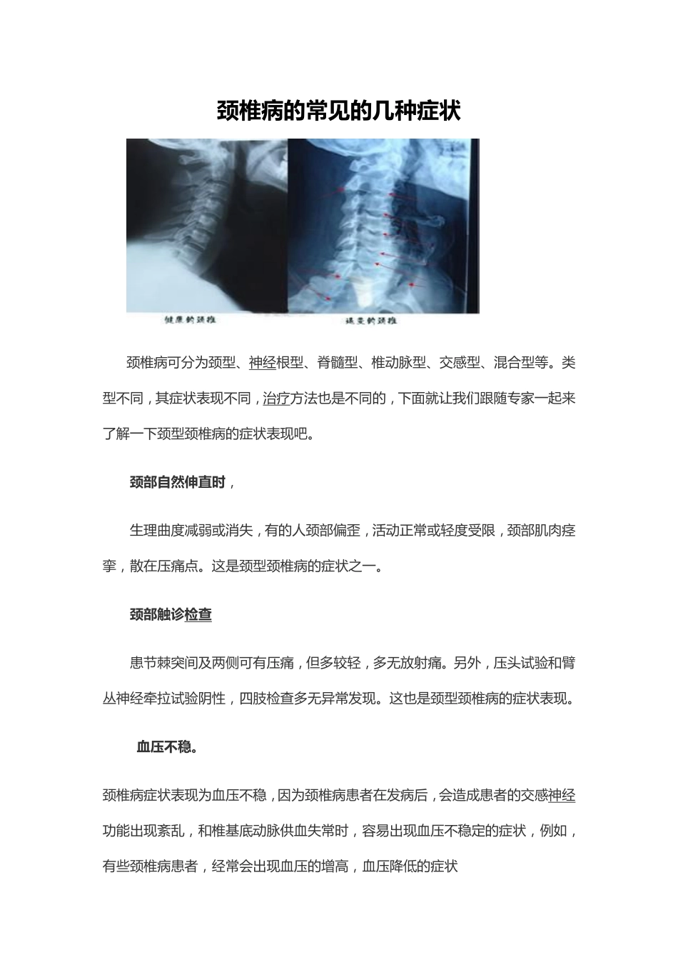 颈椎突出的症状_第1页