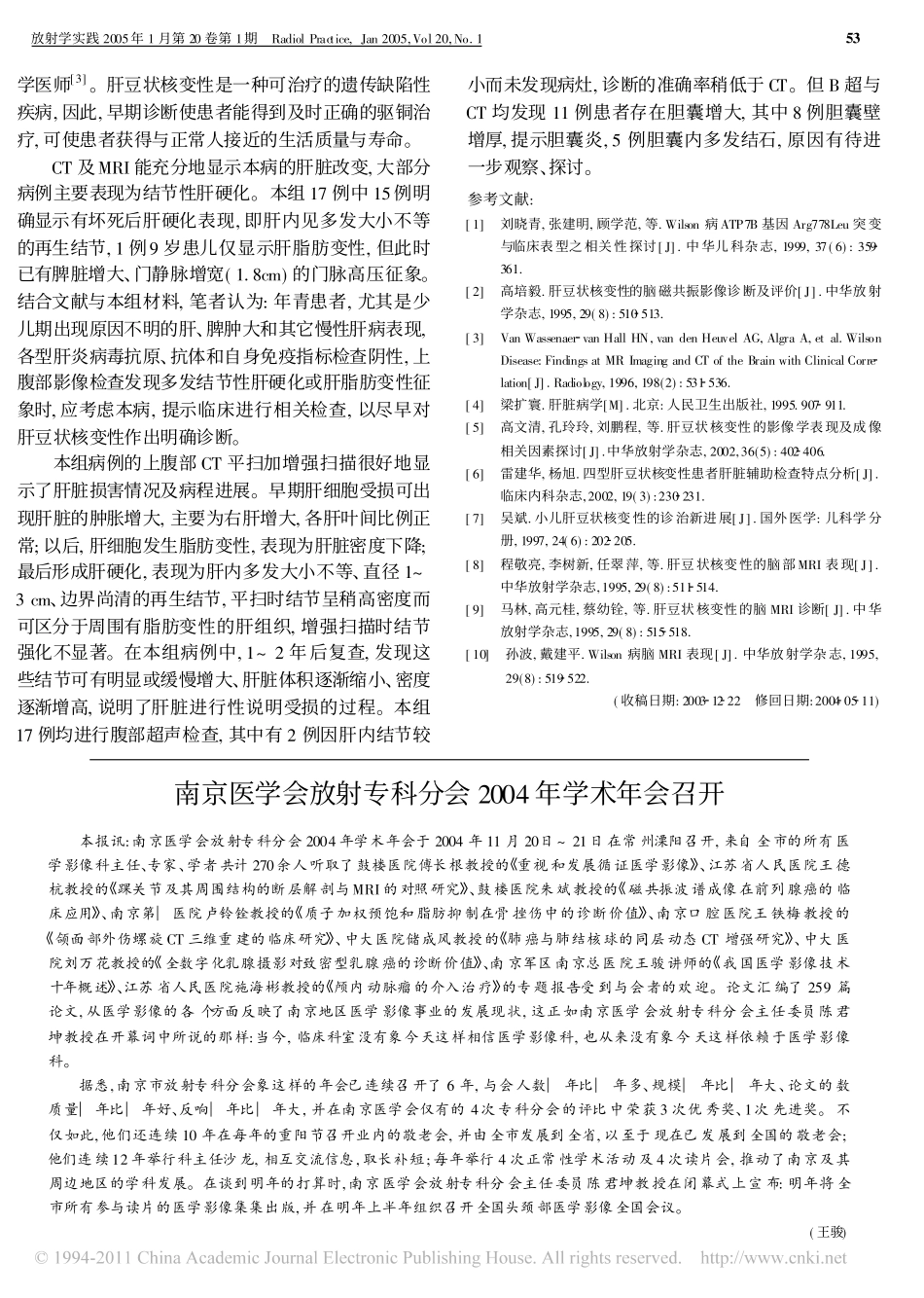 肝豆状核变性的肝影像学表现_第3页