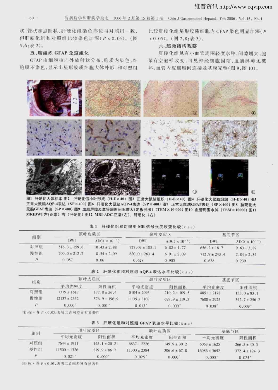 肝硬化大鼠脑水通道蛋白-4、胶质纤维酸性蛋白表达与脑水肿关系_第3页