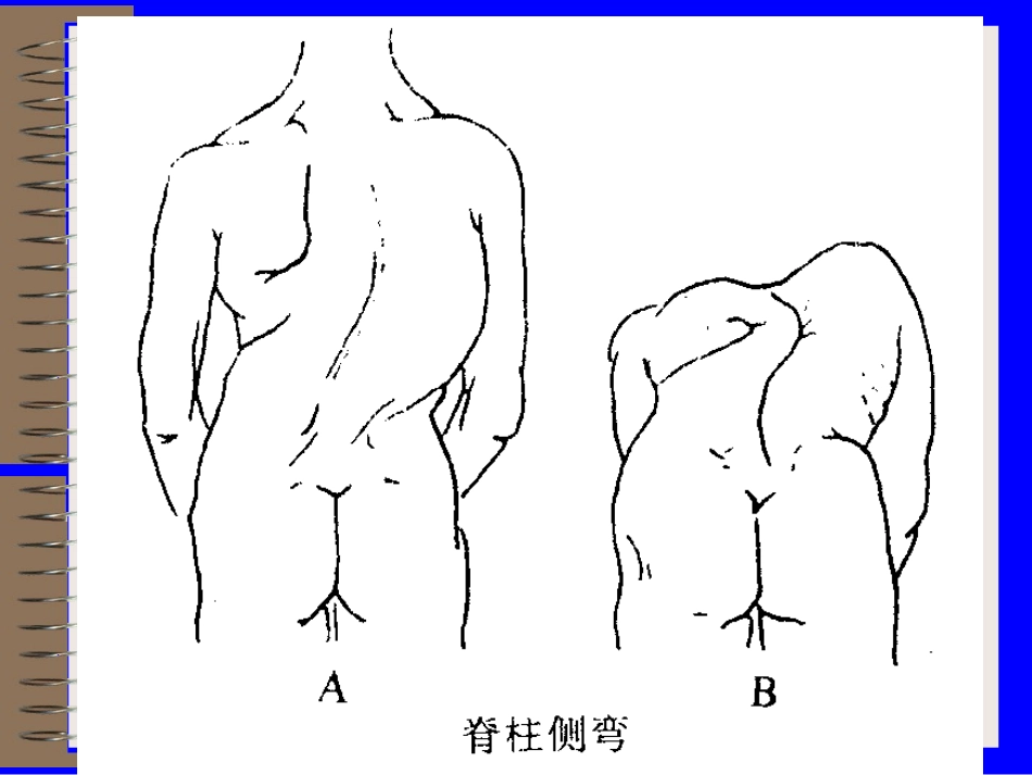 骨科神经系统检查_第3页