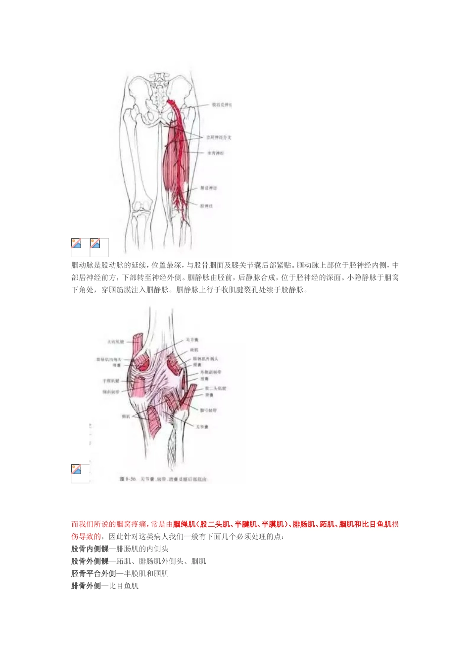 腘窝处疼痛的常见原因_第2页