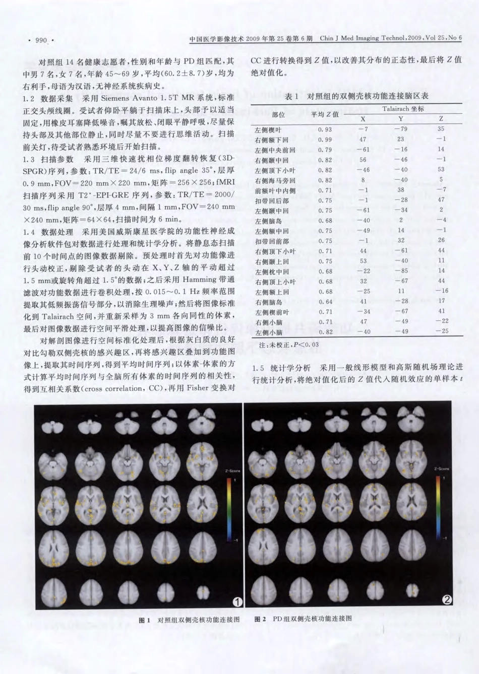 功能磁共振成像评价帕金森患者静息状态下脑功能连接_第2页