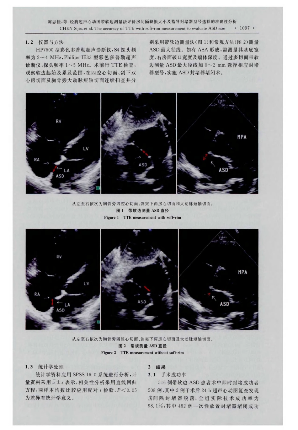 经胸超声心动图带软边测量法评价房间隔缺损大小及指导封堵器型号选择的准确性分析_第2页