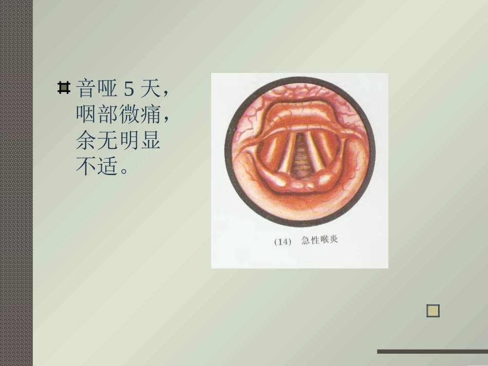 喉喑的病因病理_第3页