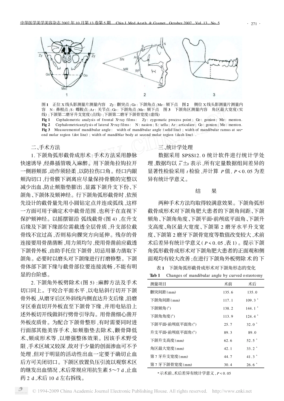 弧形截骨术和外板劈除术对下颌角形态变化的比较_第2页