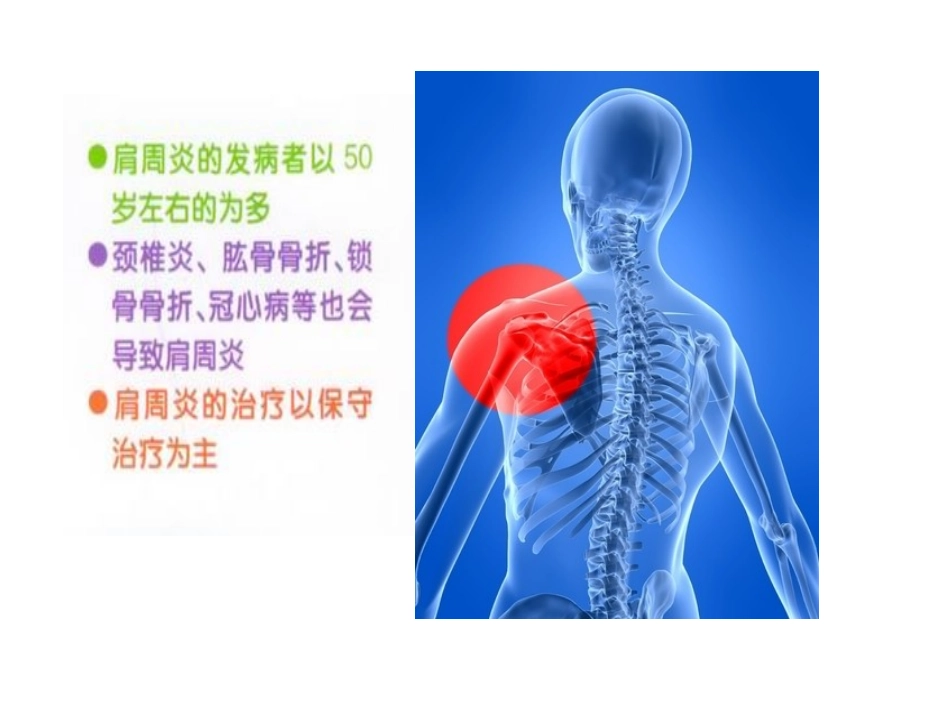 肩周炎的防治及功能锻炼_第2页