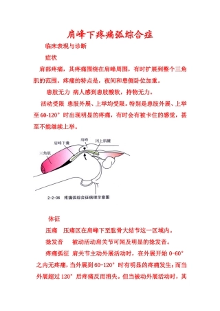 肩峰下疼痛弧综合症