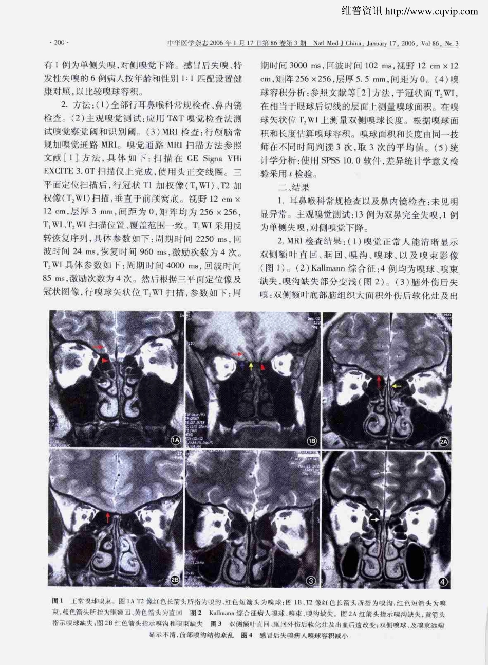 感觉神经性失嗅的磁共振成像评估_第2页