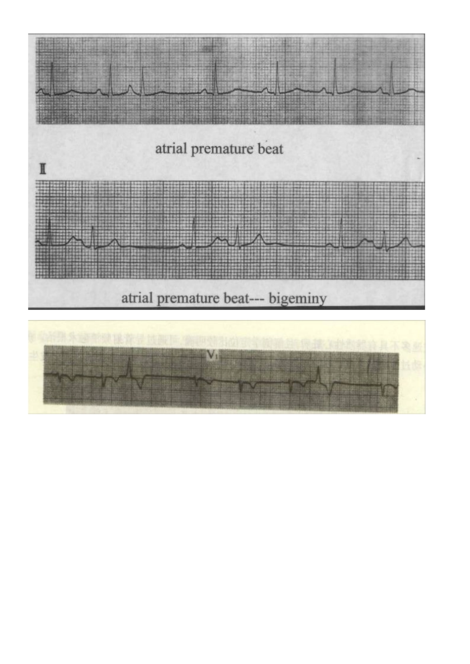 看了它就懂看心电图_第2页