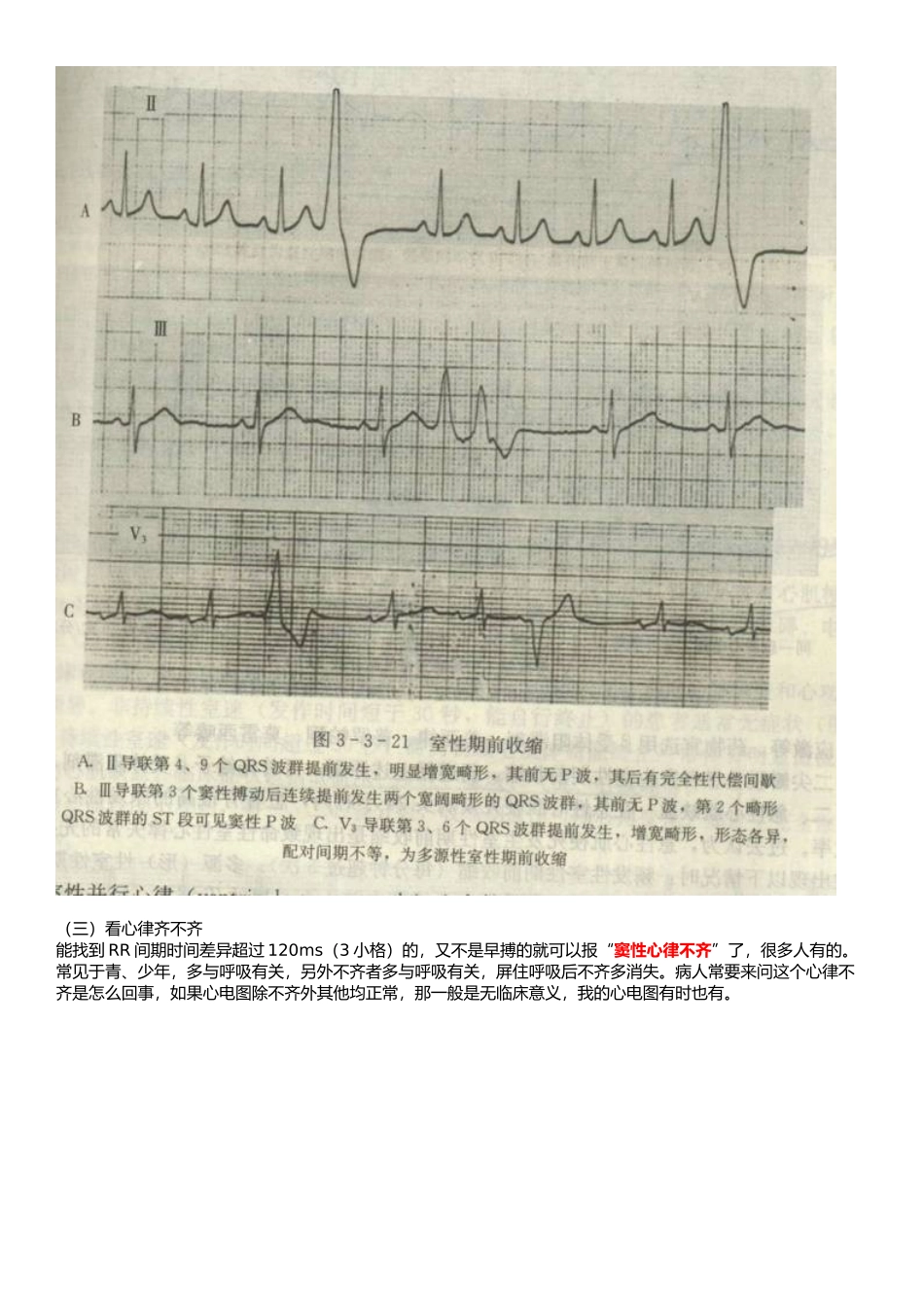 看了它就懂看心电图_第3页