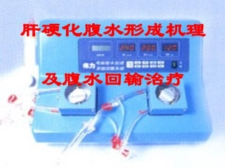 腹水回输治疗