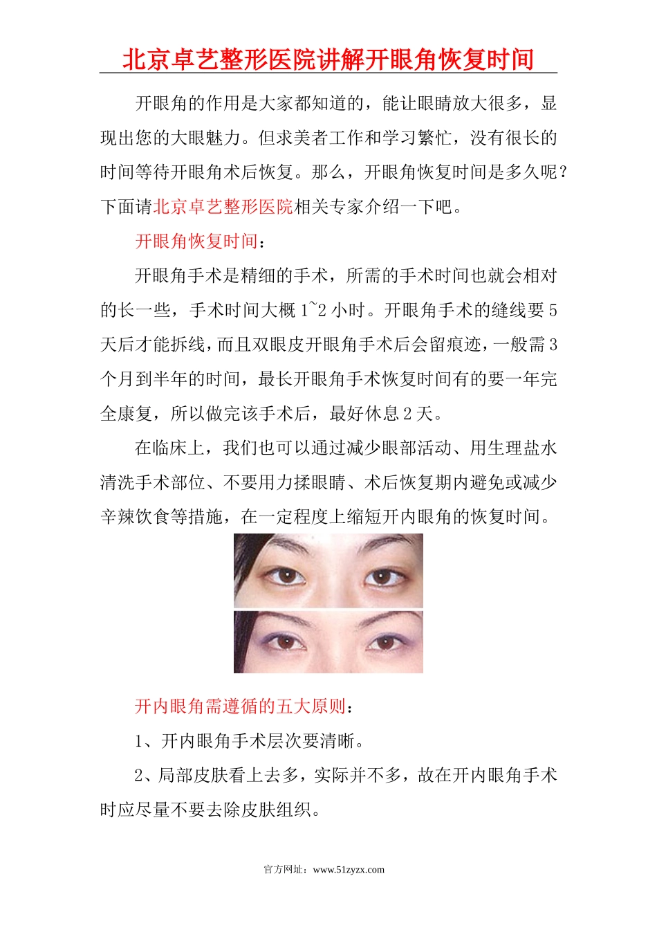 开眼角恢复时间_第1页
