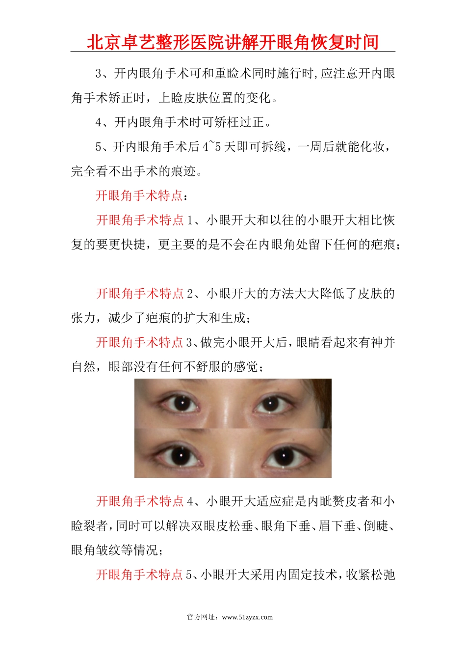 开眼角恢复时间_第2页
