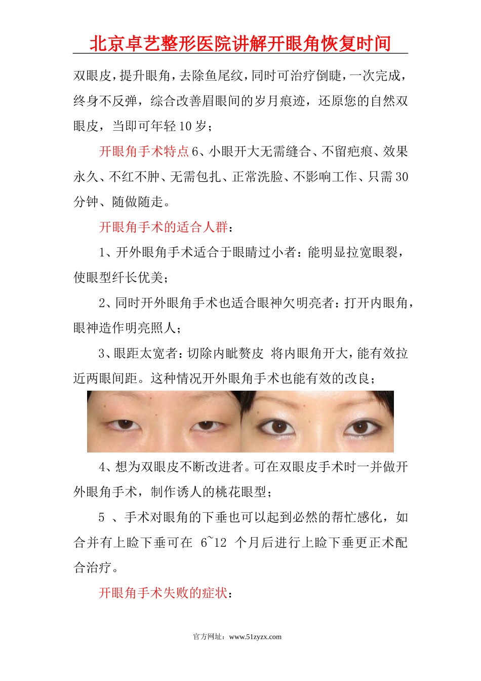 开眼角恢复时间_第3页