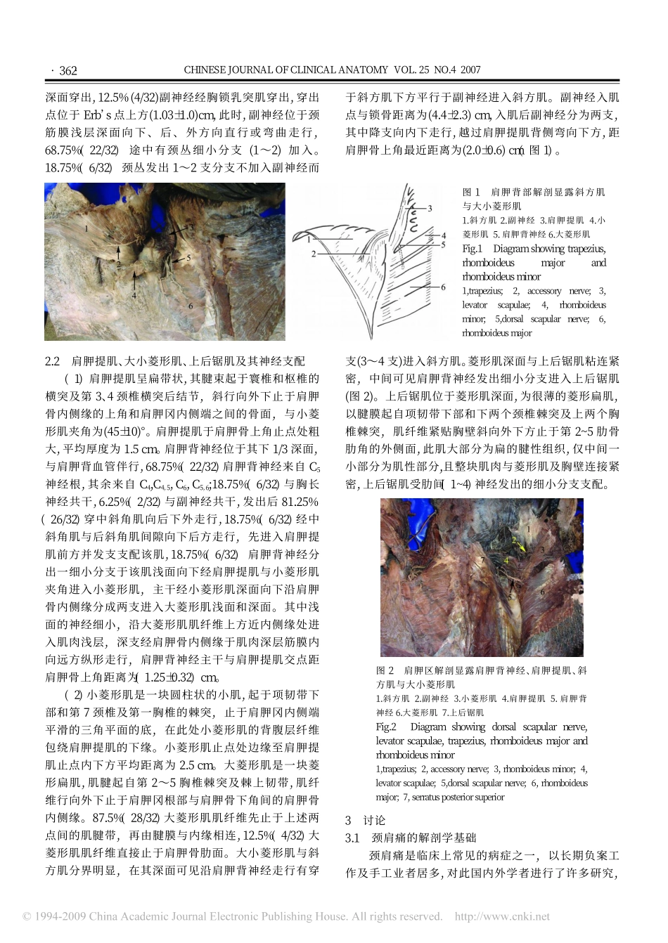 肩胛骨上角区的解剖及临床意义_第2页