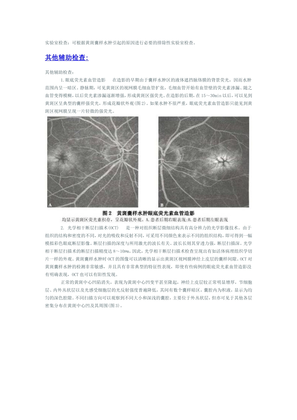黄斑囊样水肿_第3页