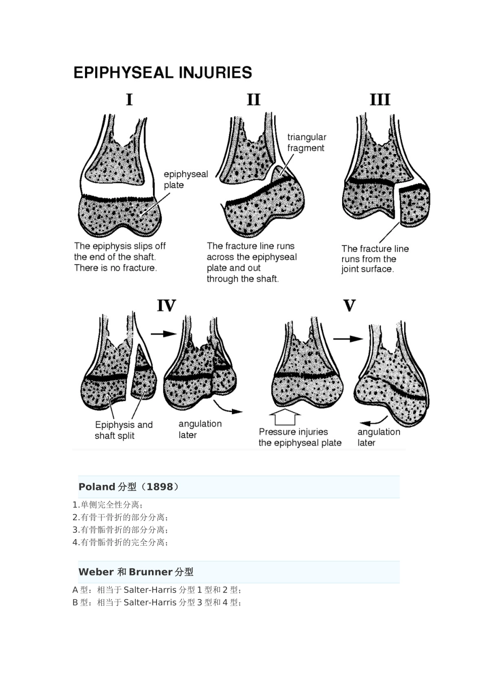 骨骺损伤的分型_第2页