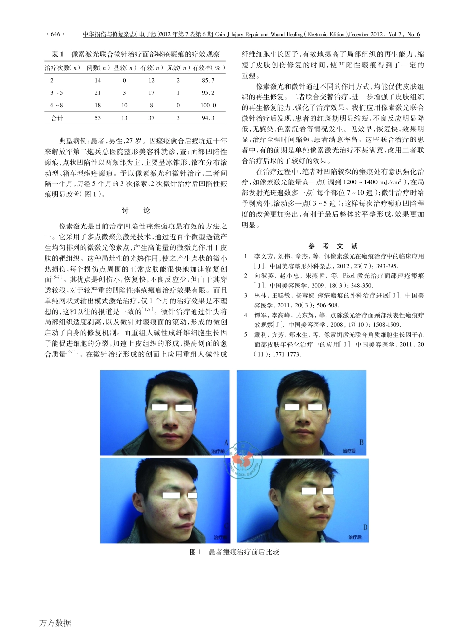 合微针治疗面部痤疮瘢痕的疗效观察_第2页