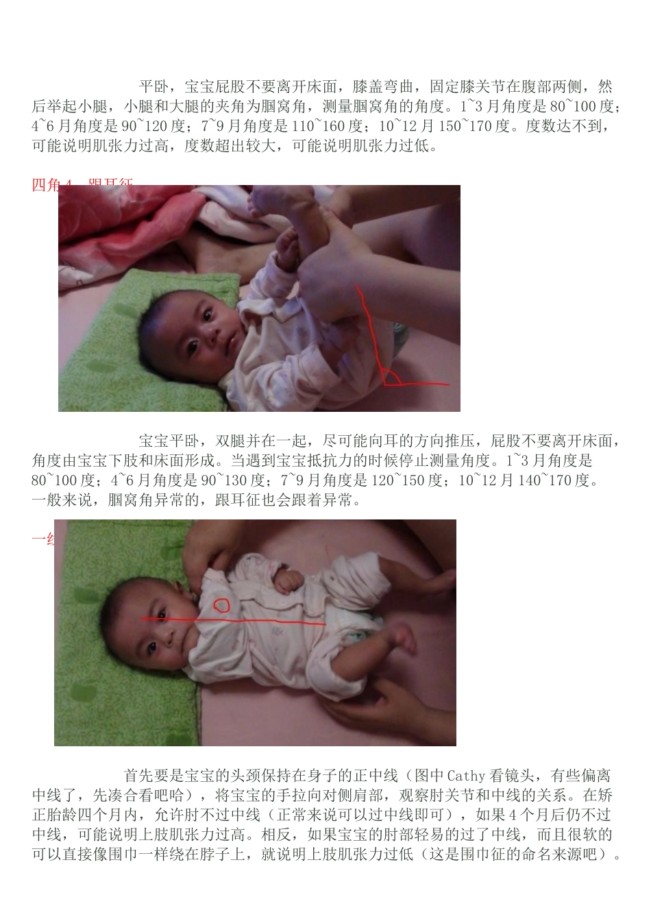 肌张力异常的判断方法_第3页