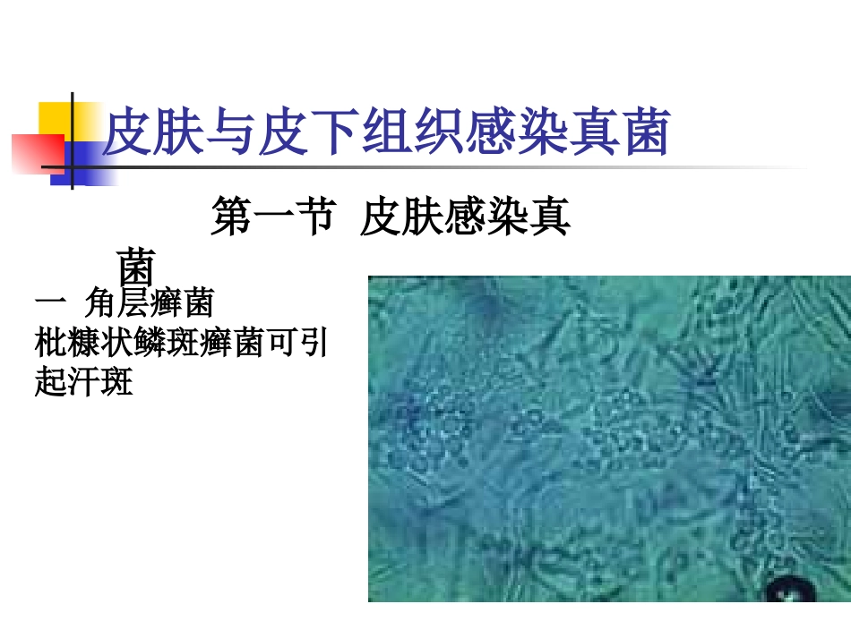 皮肤与皮下组织感染真菌_第1页