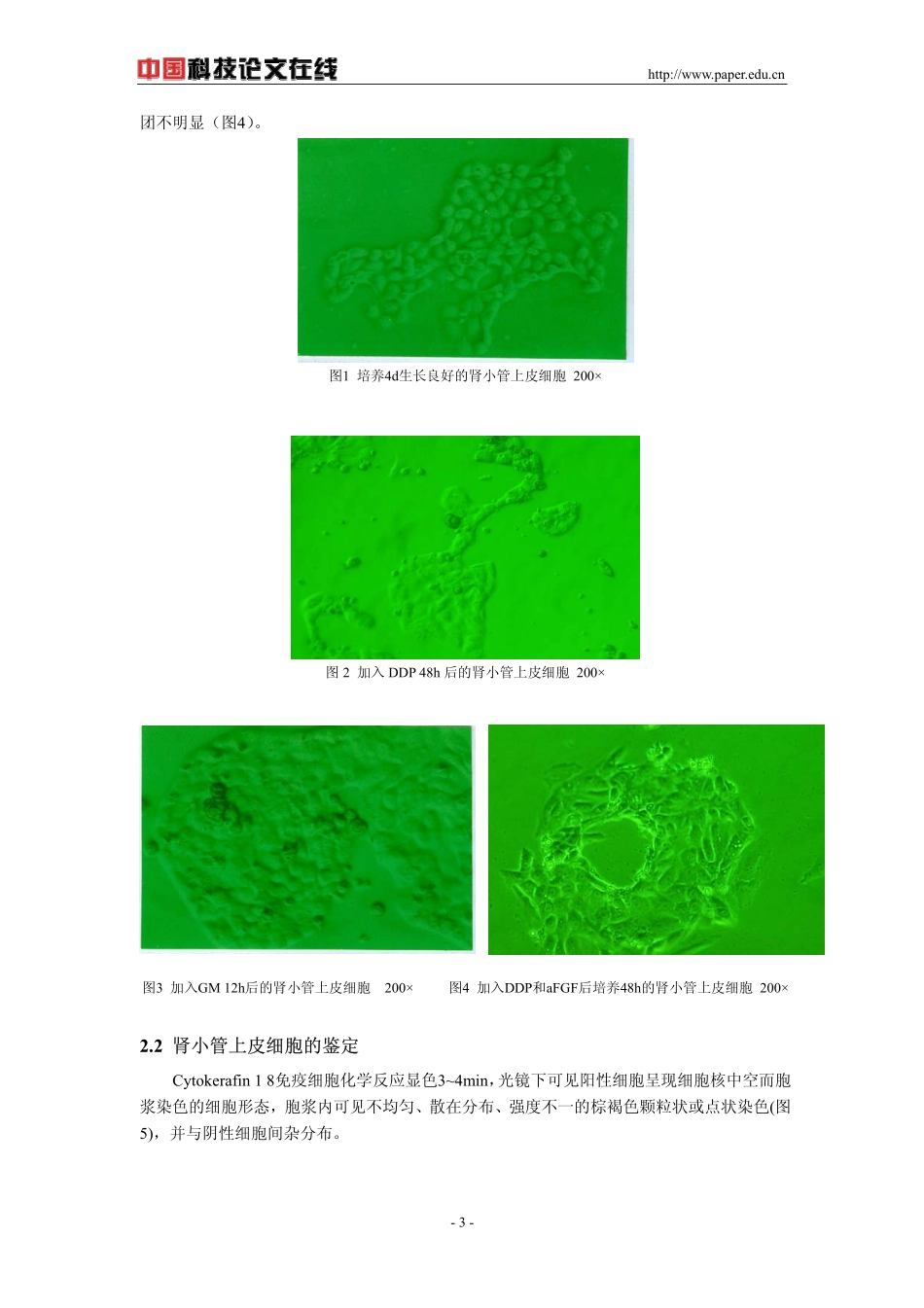 酸性成纤维细胞生长因子对庆大霉素和顺铂所致肾小管上皮细胞损伤的拮抗效应_第3页