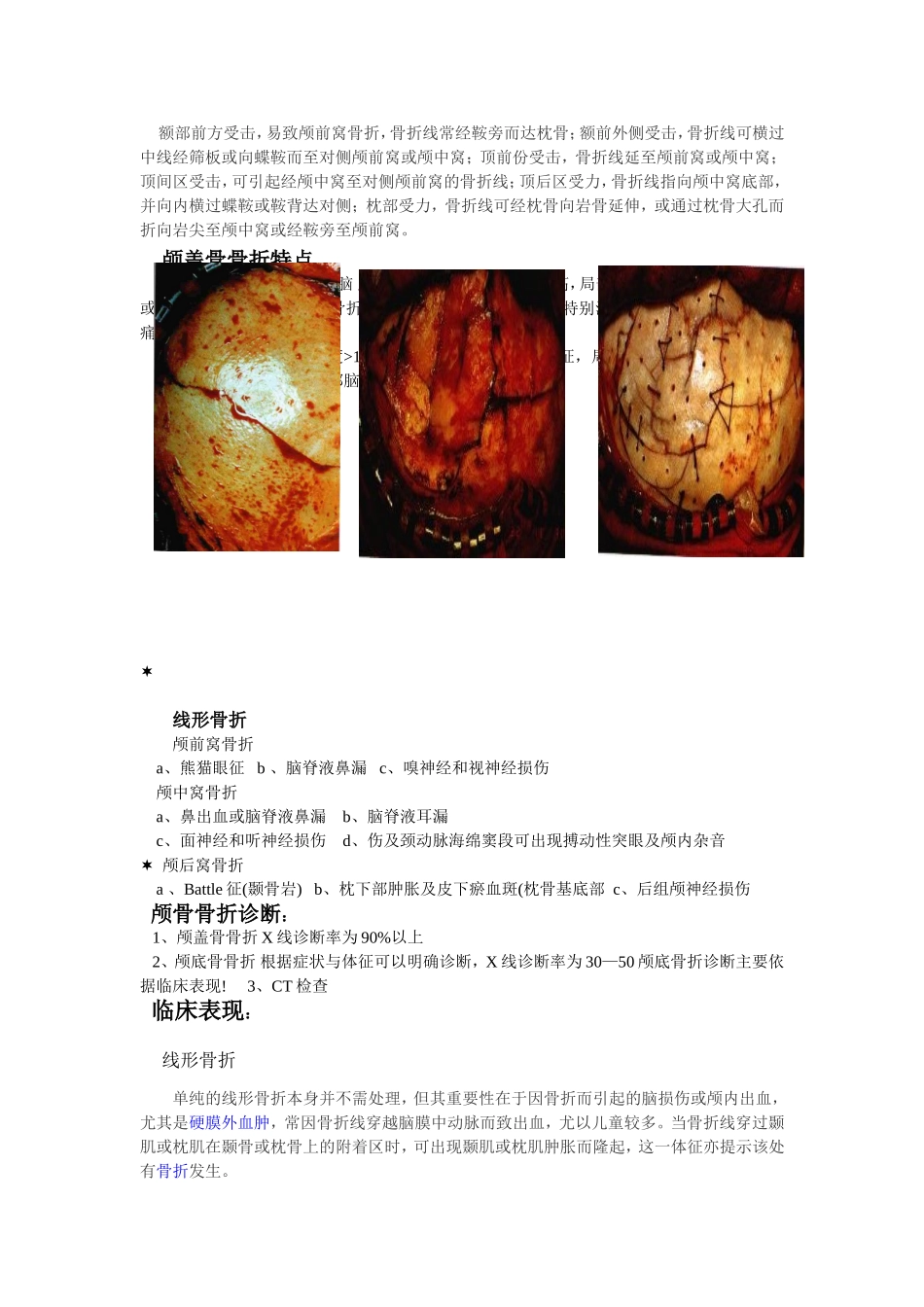 颅骨骨折申倩伟_第2页