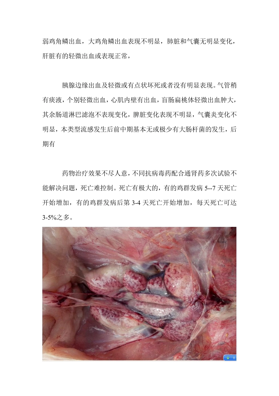 肾脏花斑性出血的原因_第3页