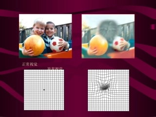 视网膜及视神经病2011