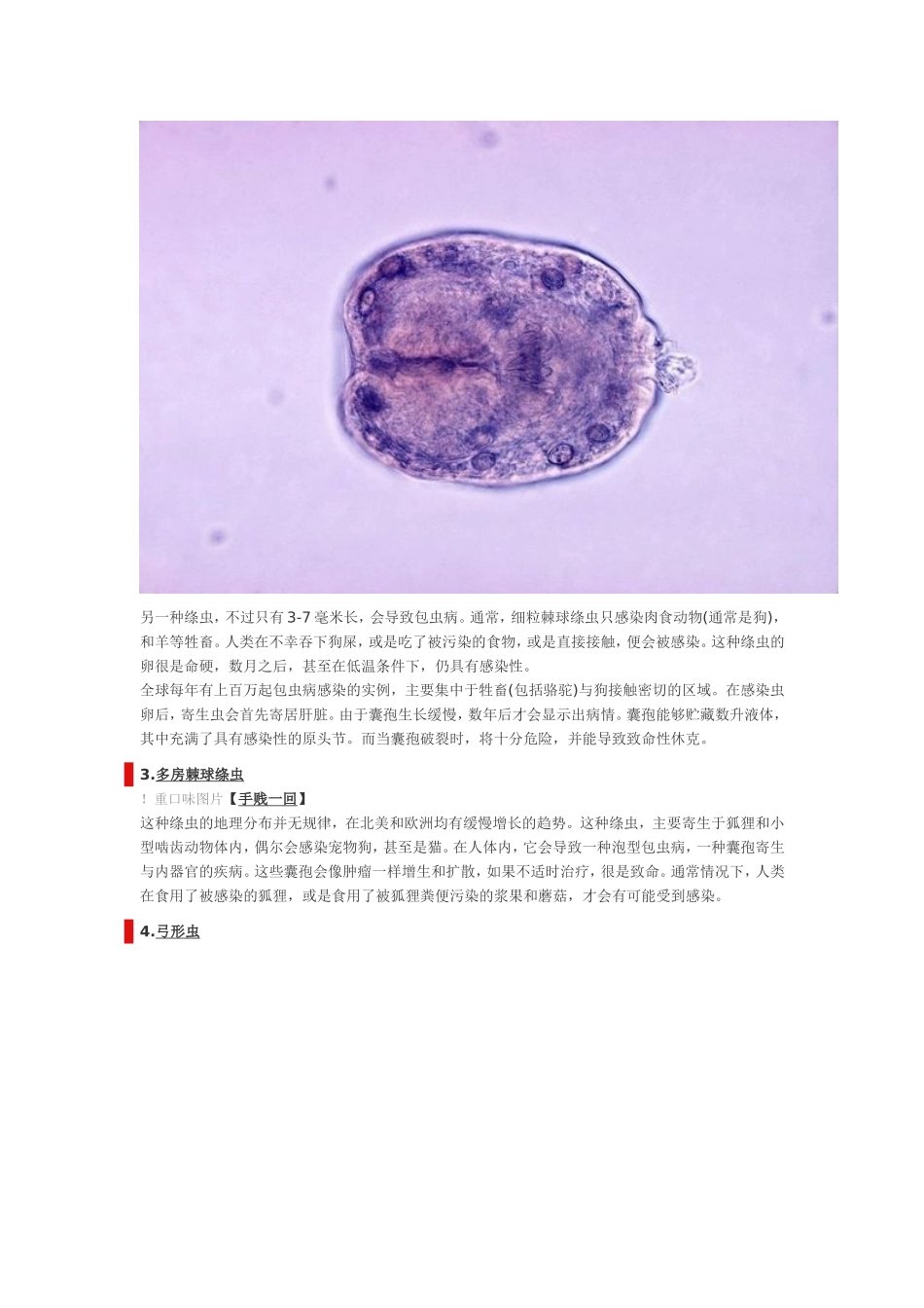 食物中可能带有的10种寄生虫_第2页