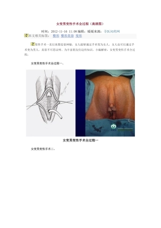 女变男变性手术