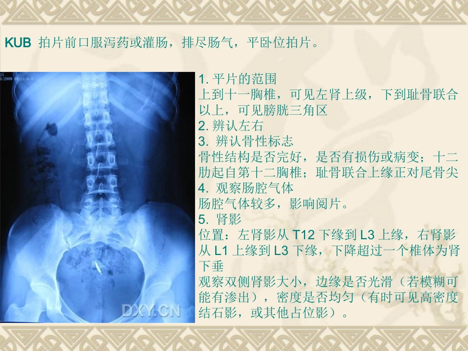 如何看KUB IVP_第3页
