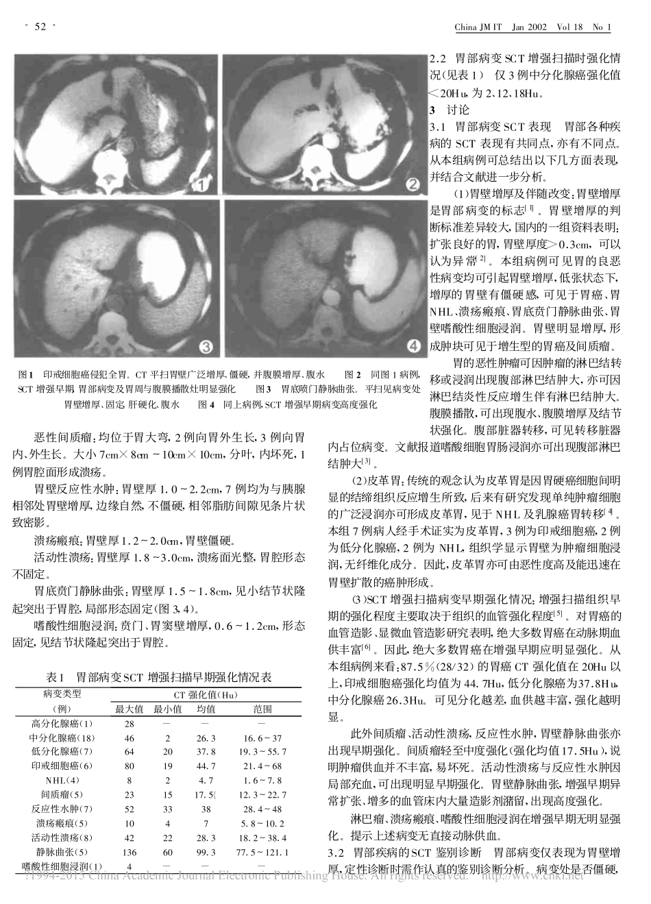 螺旋CT在胃部病变诊断中的应用_谢琦_第2页