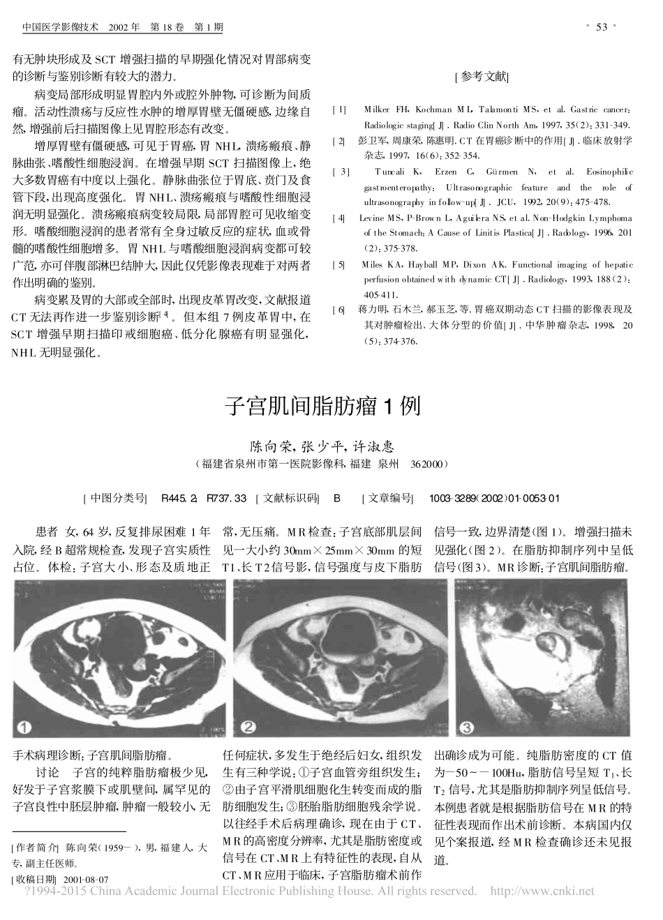 螺旋CT在胃部病变诊断中的应用_谢琦_第3页