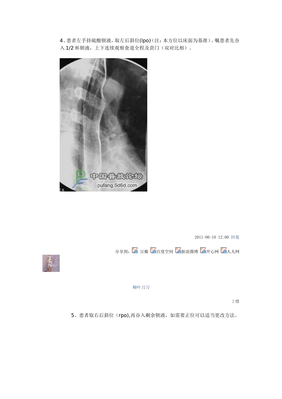 上消造影详细步骤_第2页