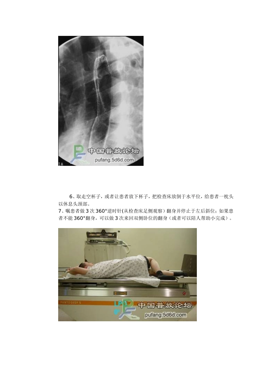 上消造影详细步骤_第3页