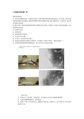 上消造影详细步骤