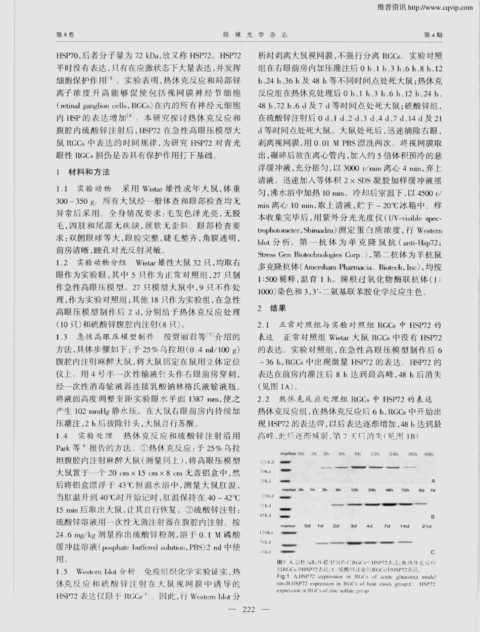 热休克蛋白72在急性高眼压模型大鼠视网膜神经节细胞中的表达_第2页