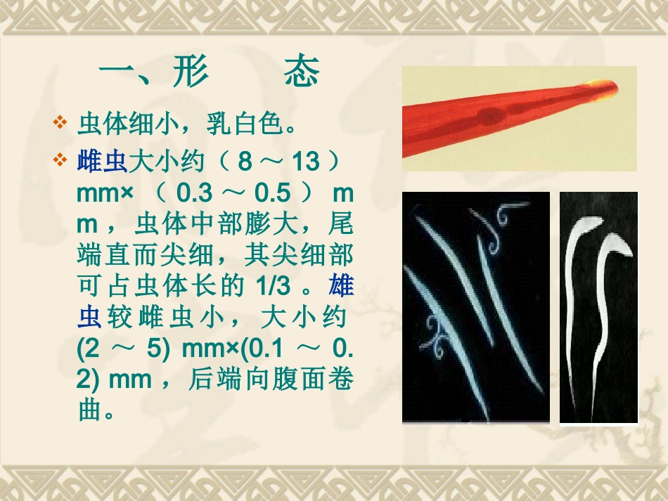 蠕形住肠线虫 (Enterobius vermicularis linnaeu - 新_第2页