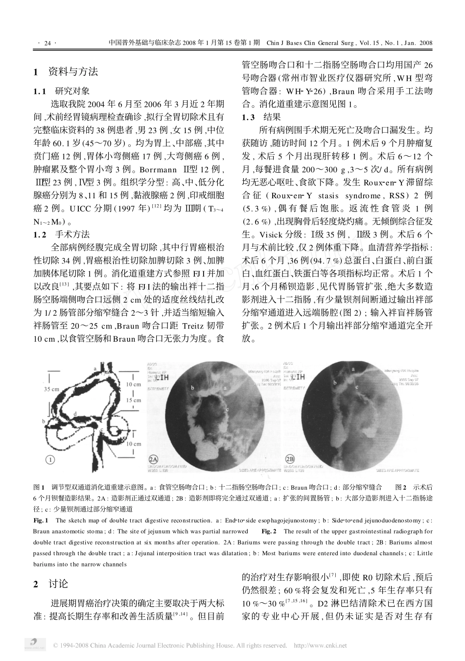 全胃切除调节型双通道间置空肠消化道重建_第2页