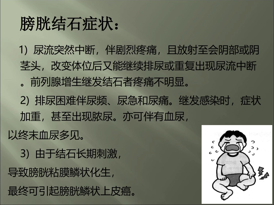 膀胱结石怎么治_第3页